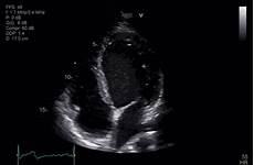 Cardiology Accessories